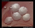 pseudomonas aeruginosa colonies